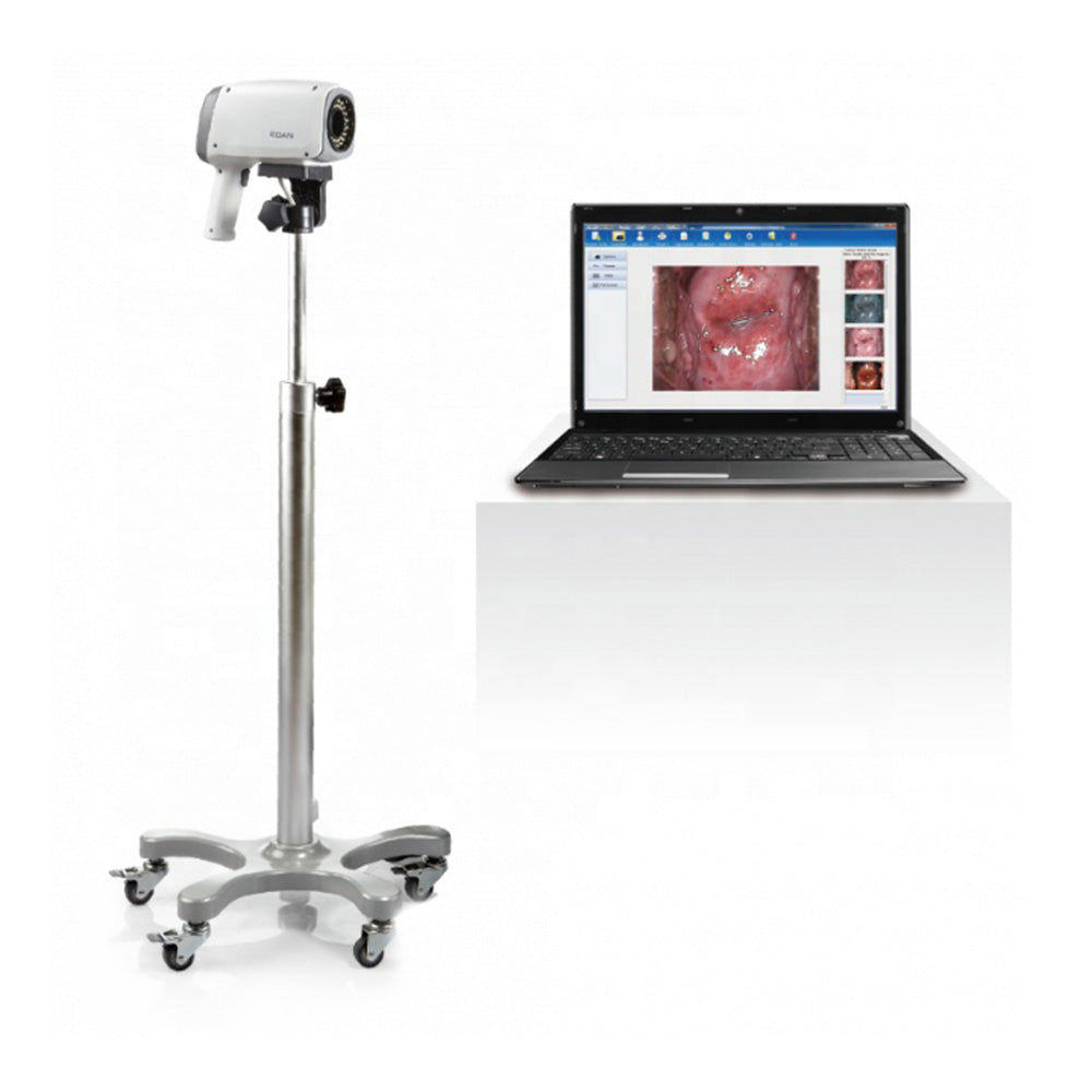 Edan C6A HD Colposcope