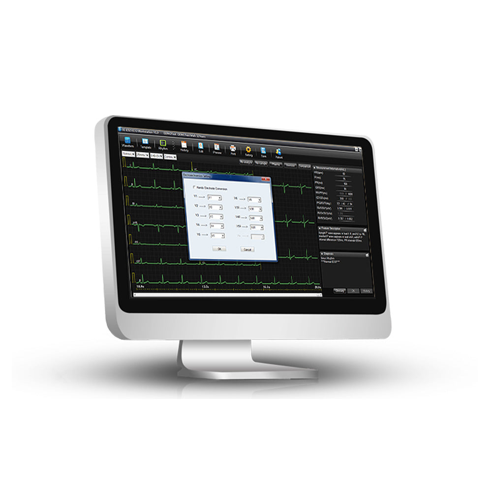 Edan SE 1515 PC ECG System