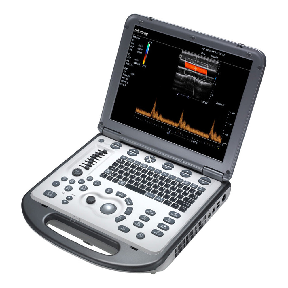 Mindray M6 Laptop Ultrasound System