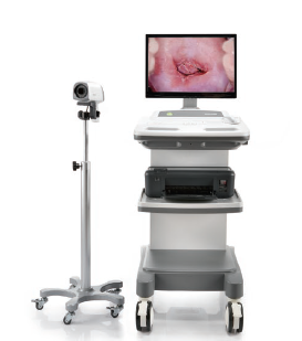 Edan C6 HD Colposcope